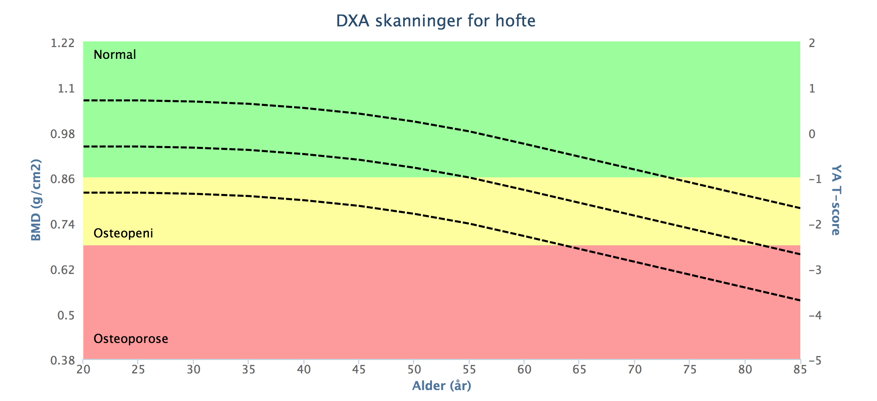 DXA Scanning